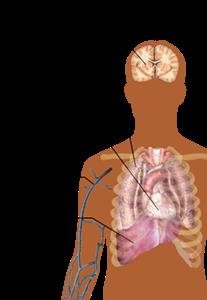 &quot;Inpatient Drug Rehab in Akron Ohio